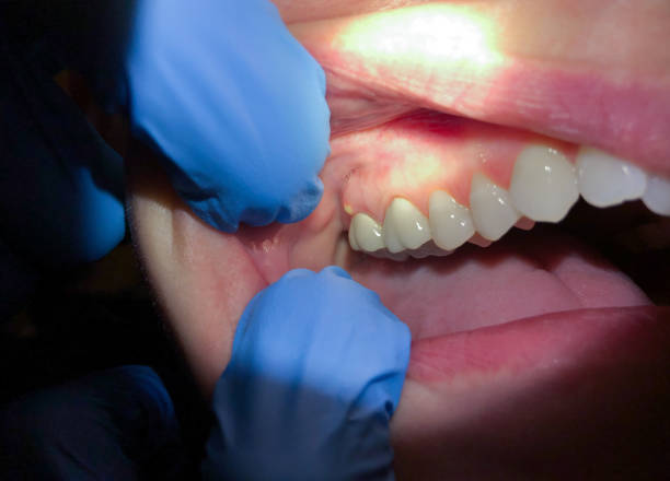 Best Walk-In Emergency Dentist in St City, AR